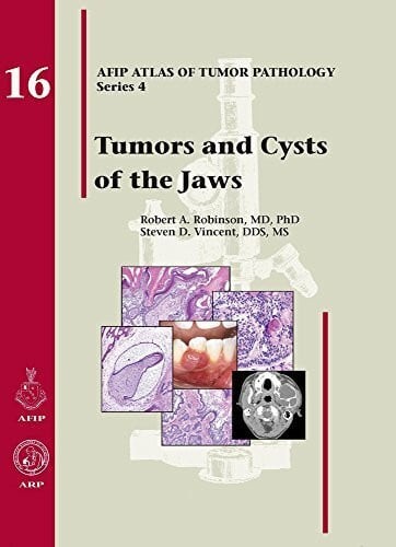 Tumors and cysts the - cysts, jaws